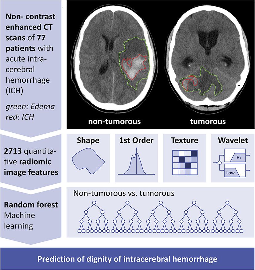 cat scan brain tumor