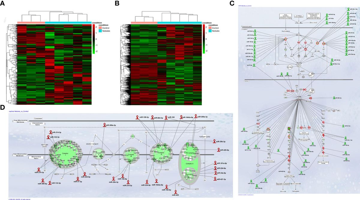 mRNA-miRNA networks identify metabolic pathways associated to the anti-tumorigenic effect of thyroid hormone on preneoplastic nodules and hepatocellular carcinoma