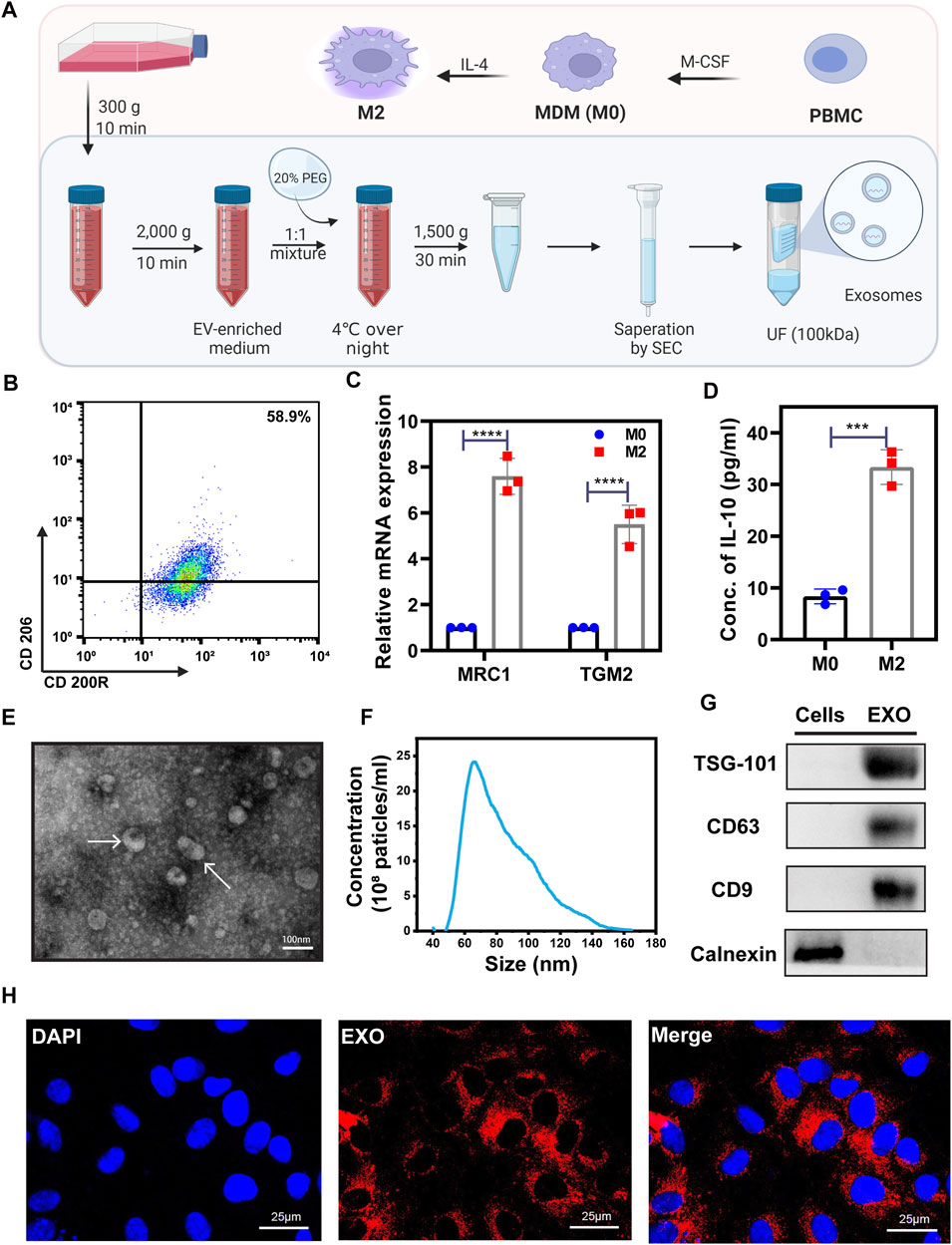 Frontiers | Exosomes derived from M2 macrophages induce