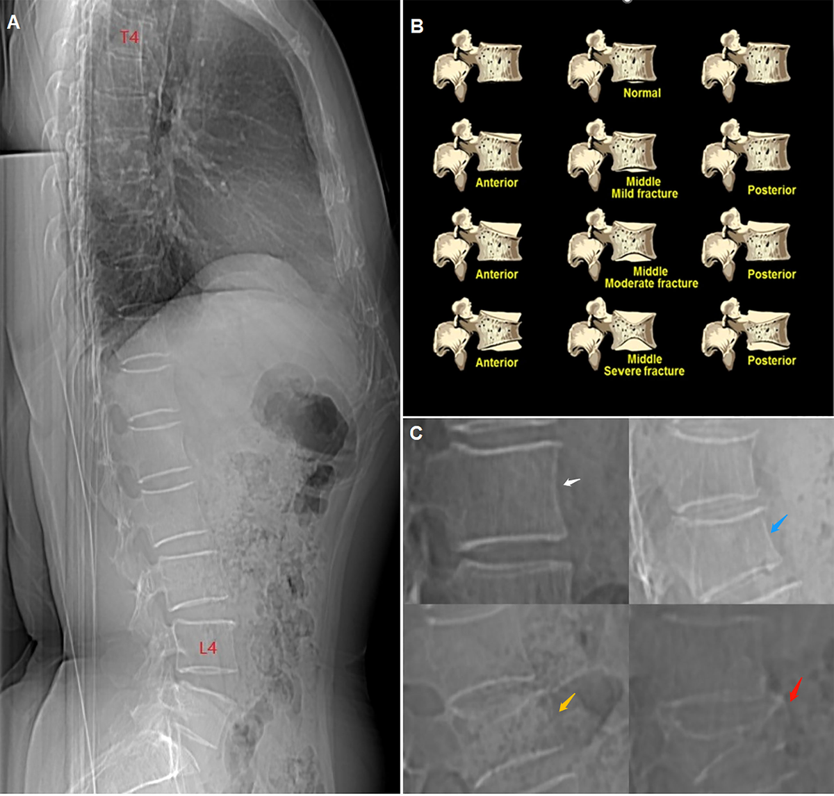 脊椎脊髄病学 = PRINCIPLES OF SPINAL DISORDERS Spinal Disorders: Fundamentals of Diagnosis and Treatment