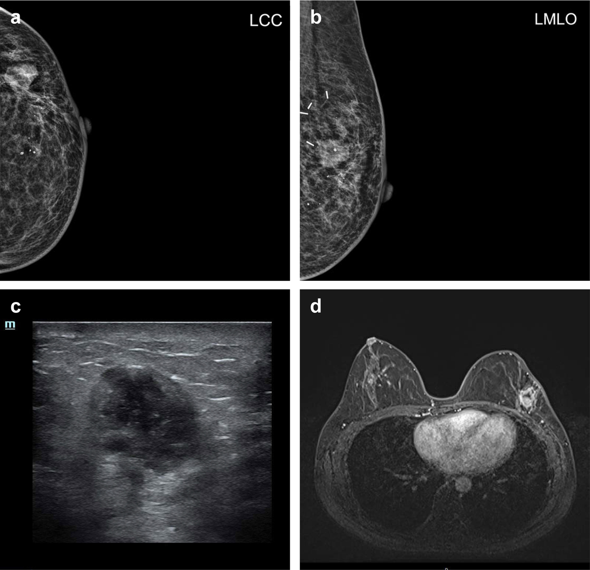 Diagnostic Breast Imaging 第2版 Women's Imaging Services | Second Read | Artificial