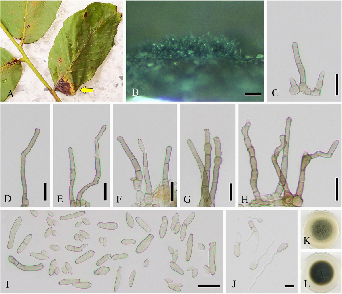 Frontiers | Morphology and phylogeny of ascomycetes