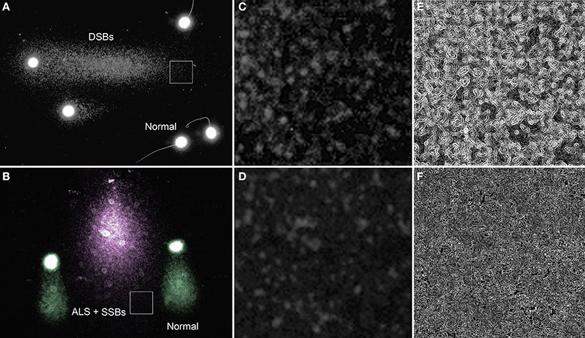 Frontiers | Interpreting sperm DNA damage in a diverse range