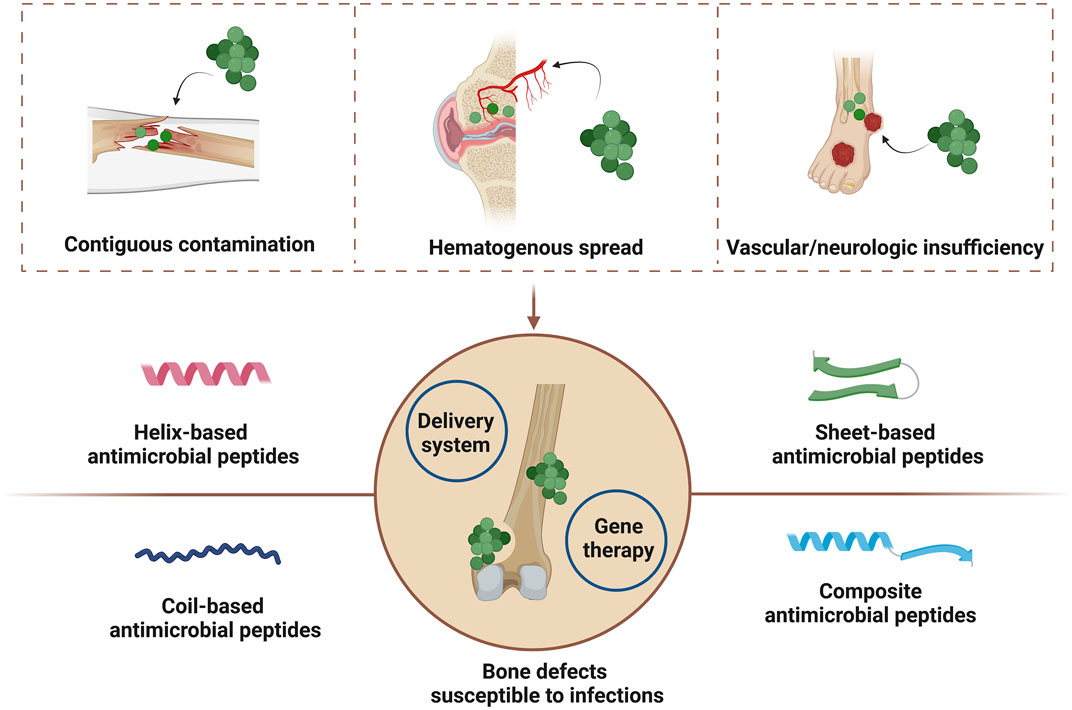 Frontiers | Antimicrobial peptides for bone tissue