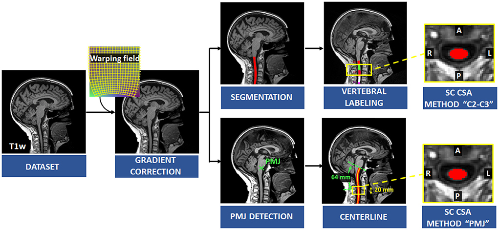 Frontiers | Automatic measure and normalization of spinal