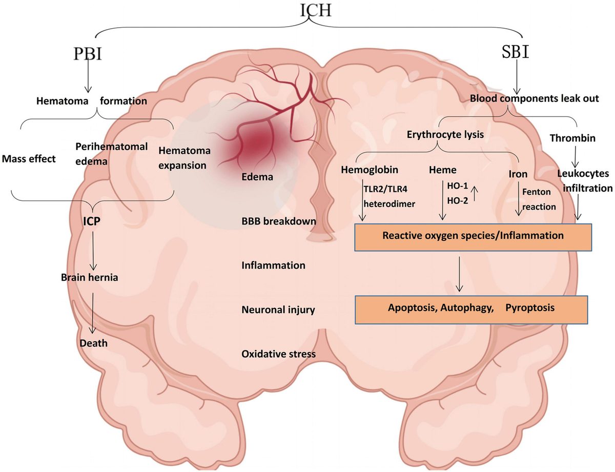 Frontiers | Autophagy regulates inflammation in