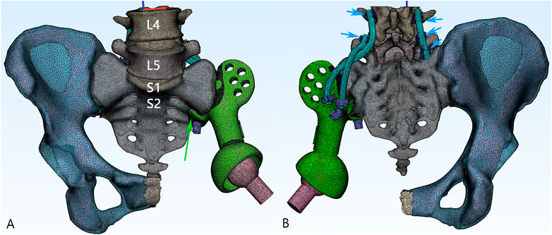 Frontiers | Reconstruction with 3D-printed prostheses after