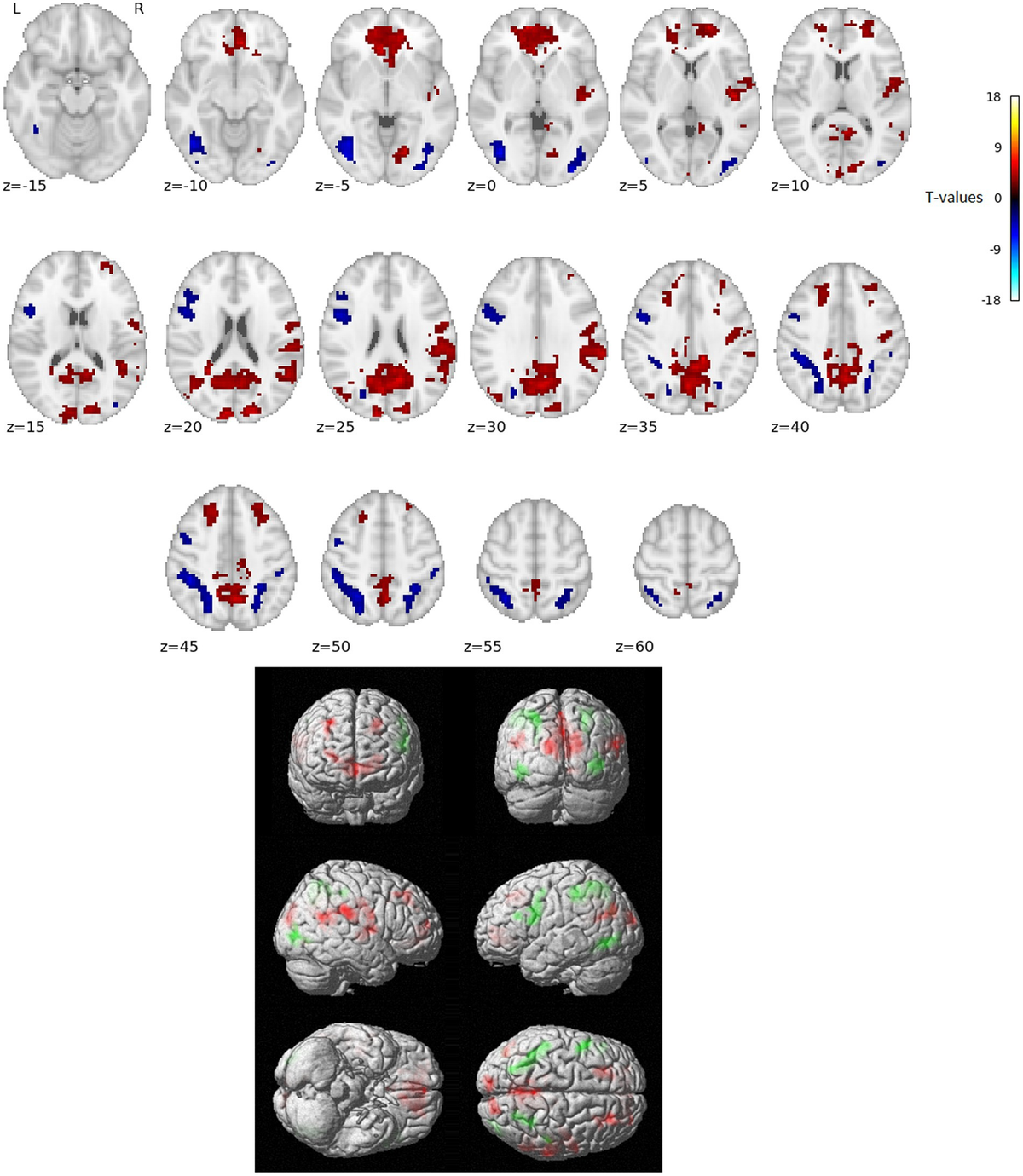 Functional neuroanatomy of reading in Czech: Evidence of a dual-route  processing architecture in a shallow orthography - Frontiers