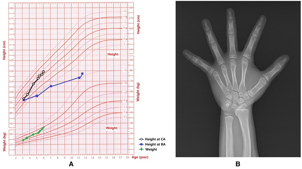 MaBLE SYNDROMe MARiA　メイリア Frontiers | Methylmalonic aciduria as a biochemical marker