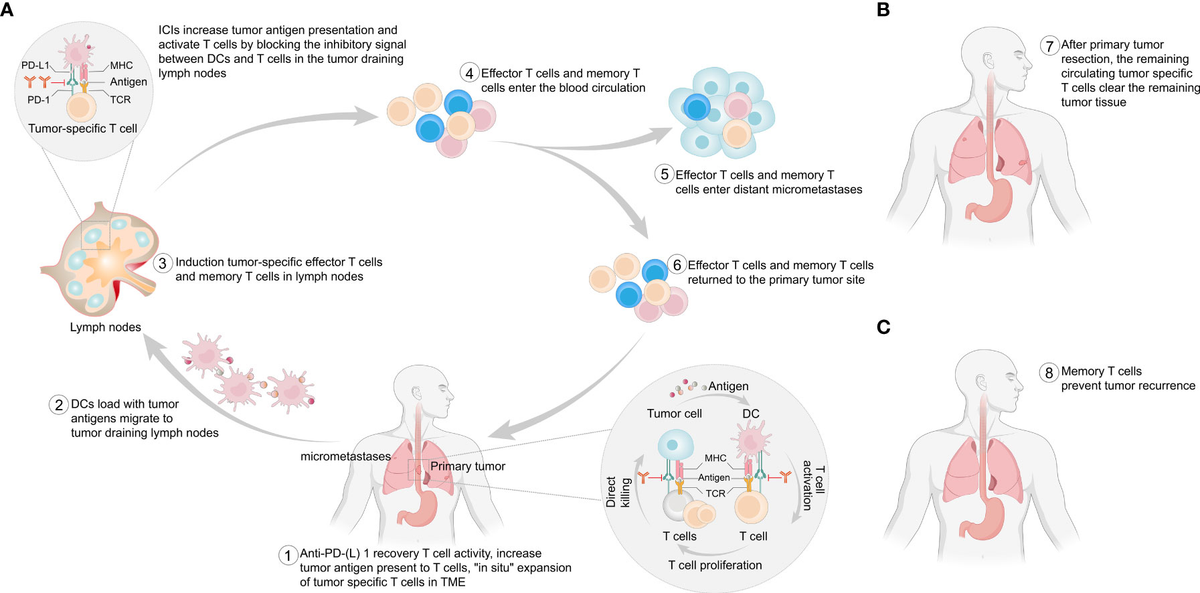 その他 In the Clear [CD] Frontiers | Neoadjuvant immunotherapy for resectable