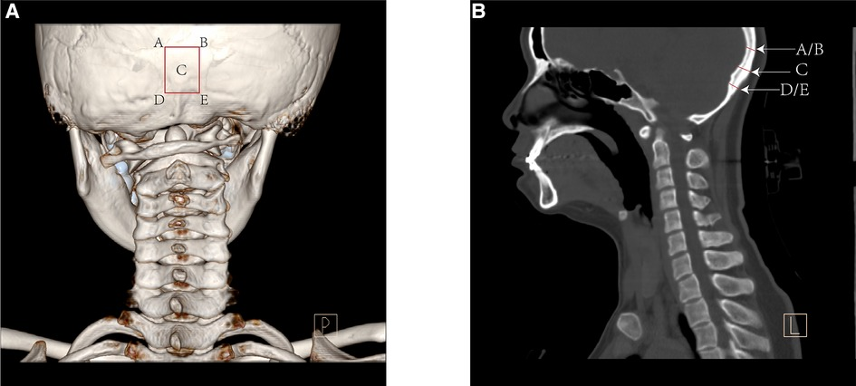 新版　頭頸部手術　カラーアトラス　Head &amp; Neck Surgery 81pqlJCZlTL._UF350,350_QL50_.jpg