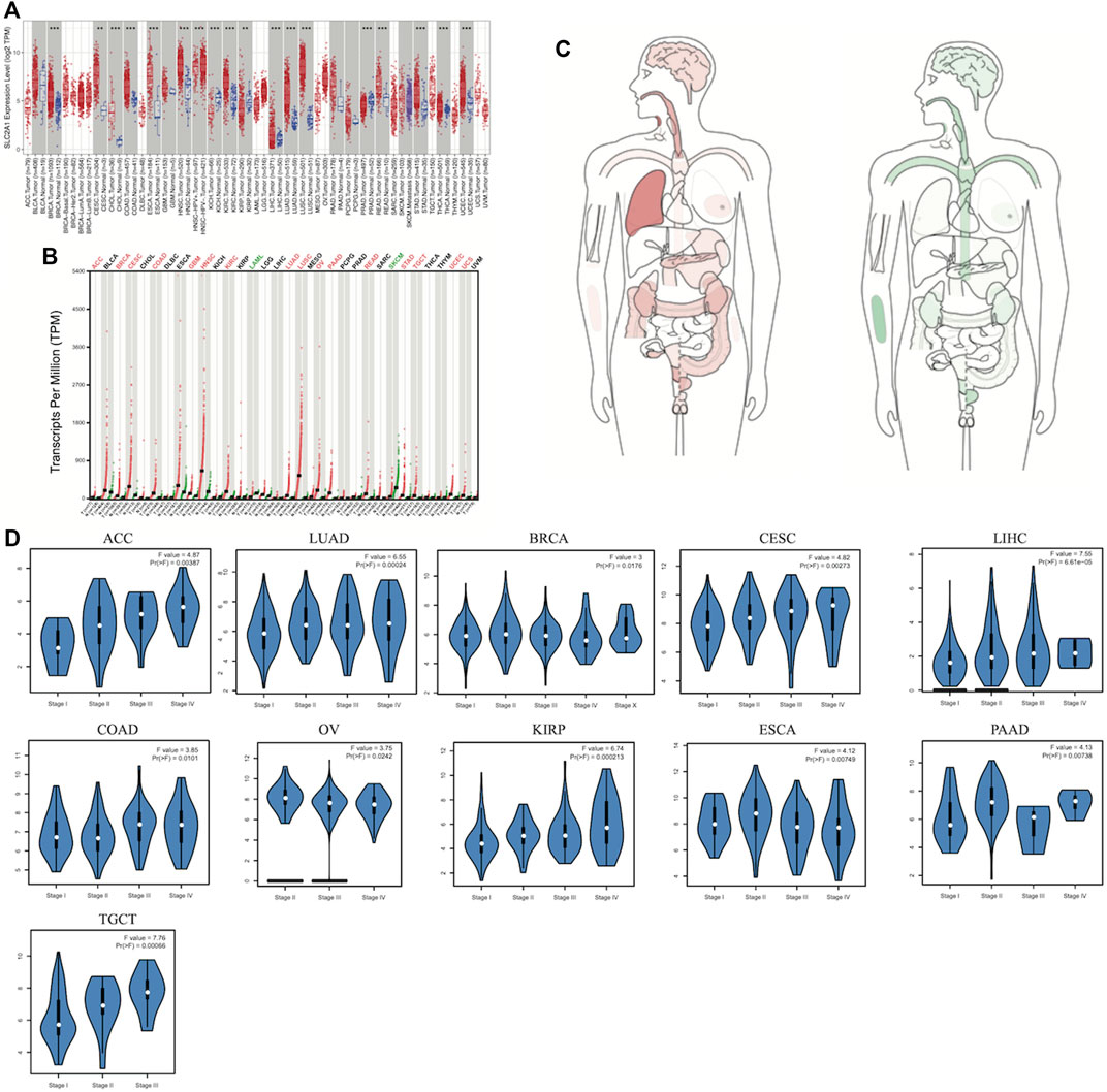Cell death-related biomarker SLC2A1 has a significant role in prognosis  prediction and immunotherapy efficacy evaluation in pan-cancer - Frontiers