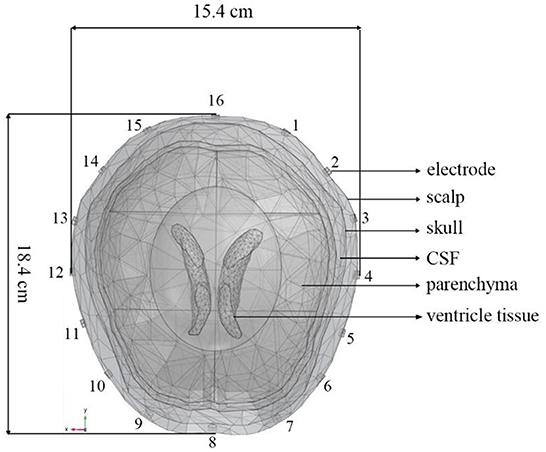 eeg 2012年 Using amplitude-integrated EEG in neonatal intensive care
