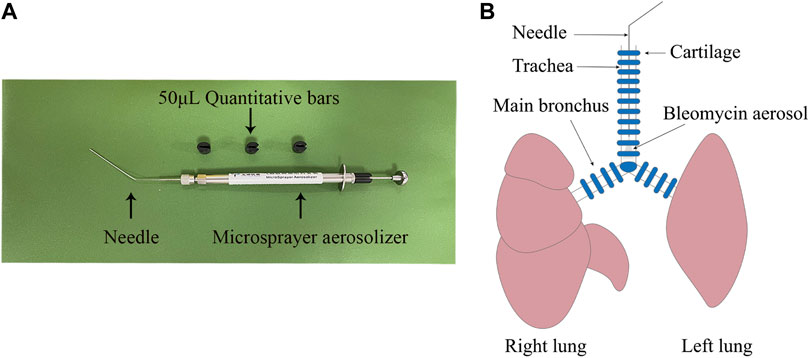 Frontiers | Enhanced secretion of hepatocyte growth factor