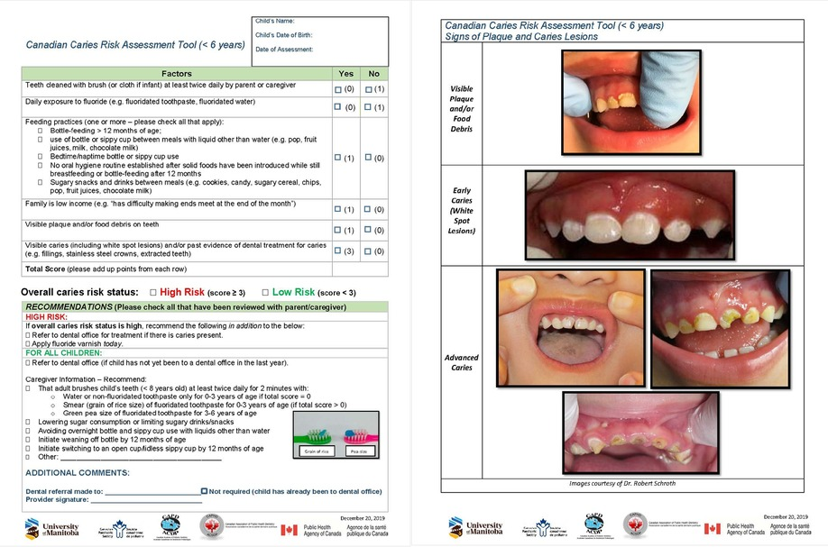 Dental Teeth Model - Alta Dental Solution