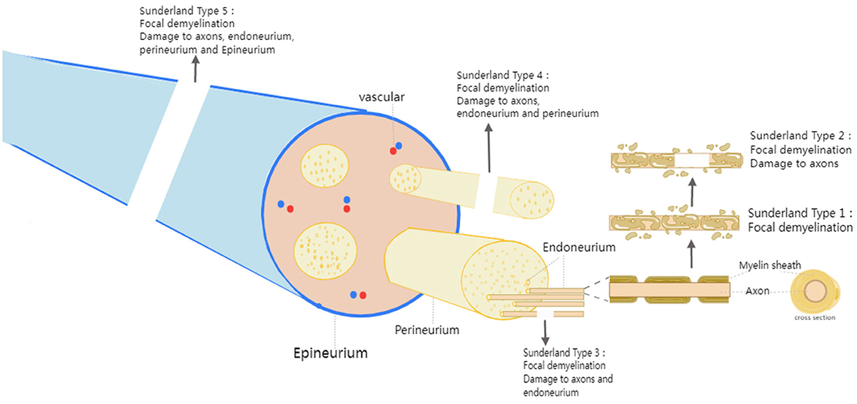 Frontiers | Electrical stimulation therapy for peripheral
