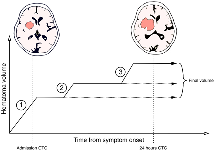 Frontiers | Prediction and Observation of Post-Admission
