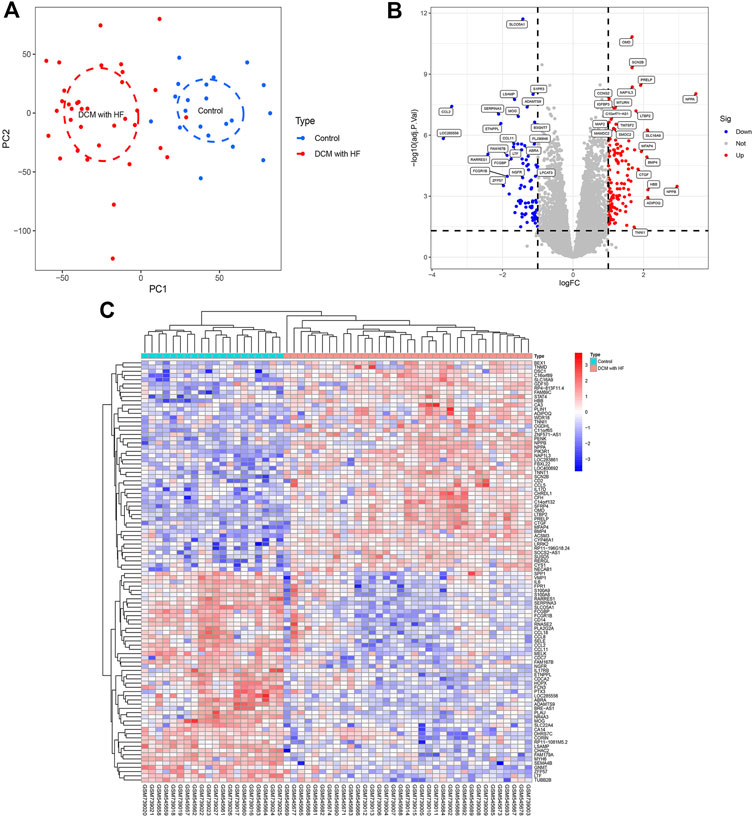 Frontiers Integrated analysis of WGCNA and machine learning