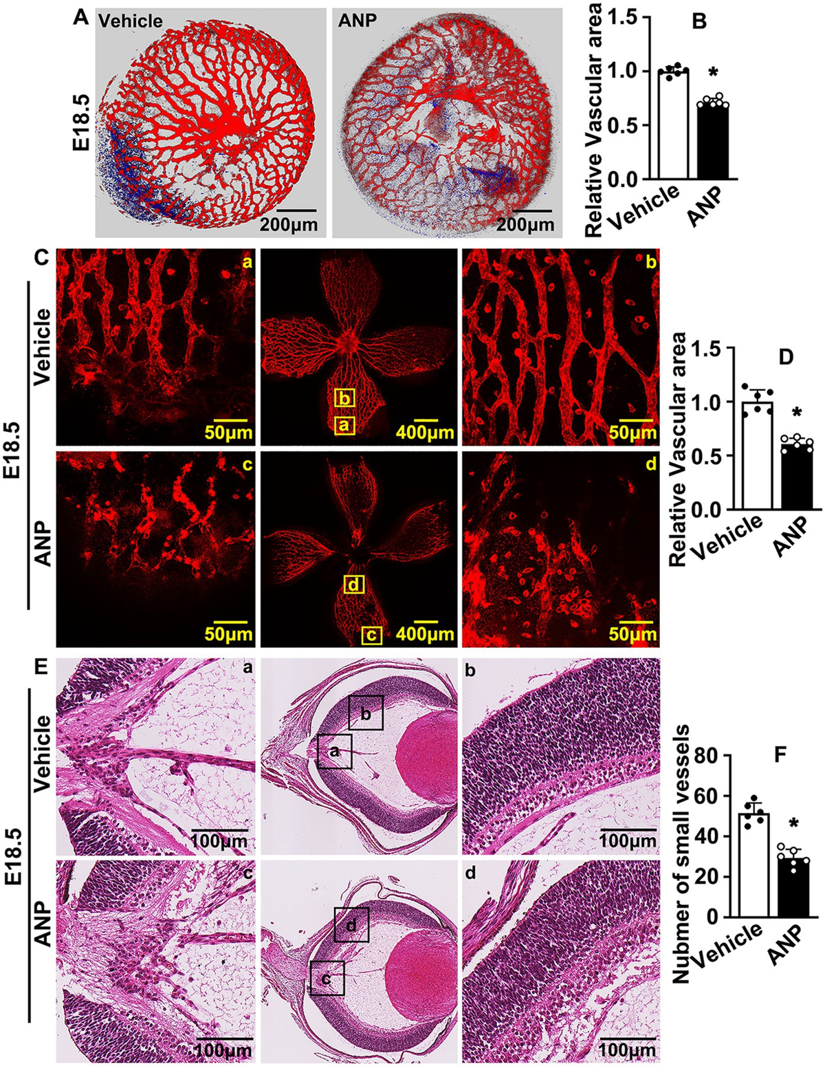 Frontiers | Andrographolide suppresses hypoxia-induced