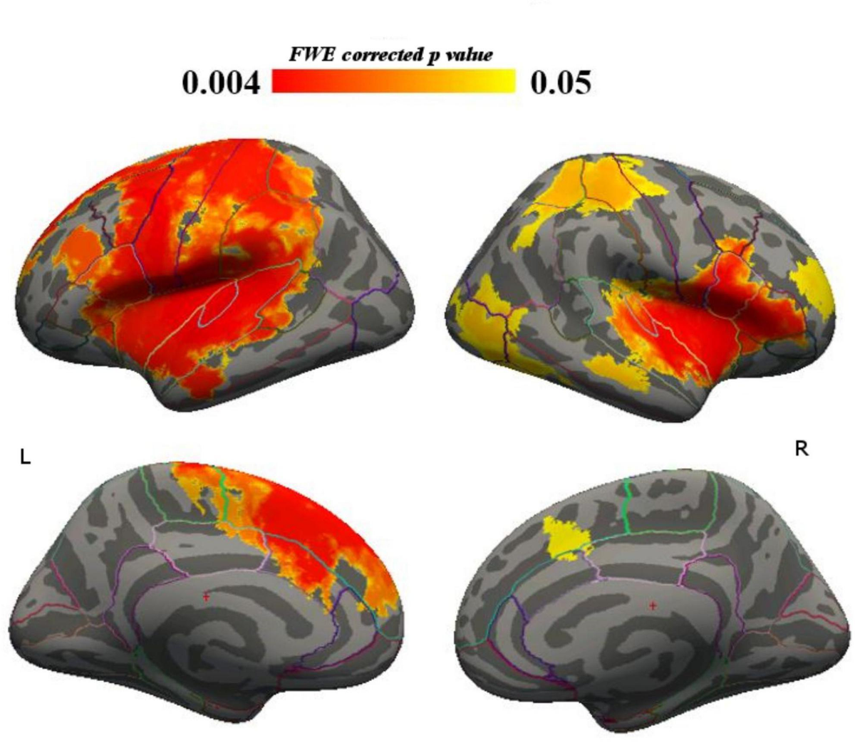 Frontiers | Correlations between cortical gyrification and