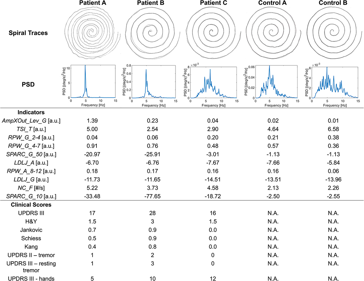 Frontiers | Spiral drawing analysis with a smart ink pen to