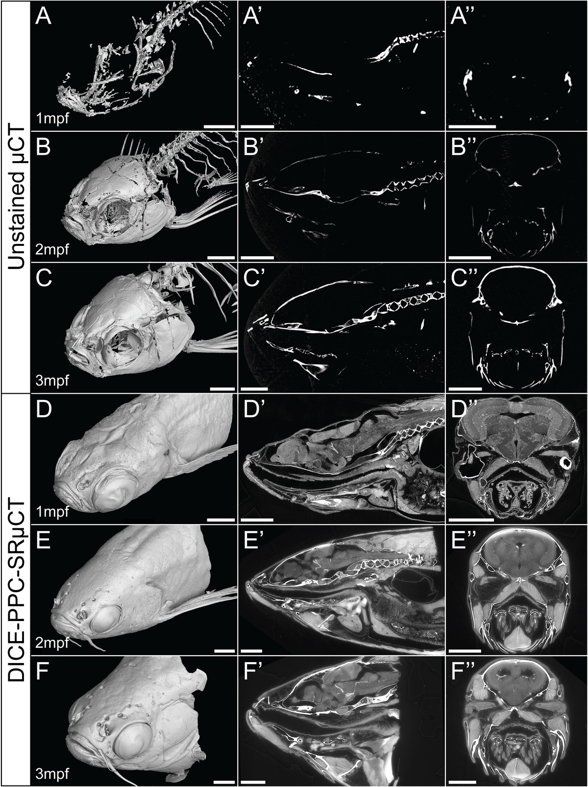 Frontiers | Enhanced contrast synchrotron X-ray