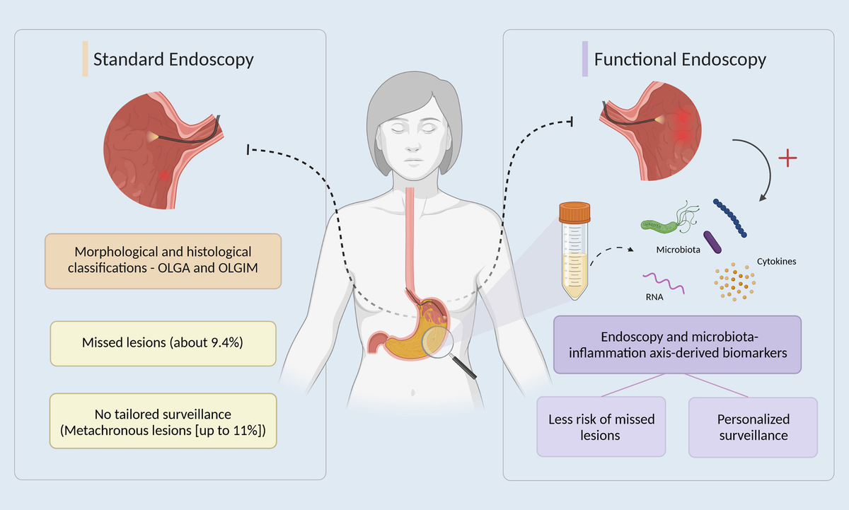 Frontiers | Linking dysbiosis to precancerous stomach