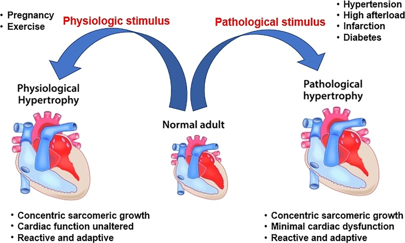 Frontiers | Toll-like receptors in cardiac hypertrophy