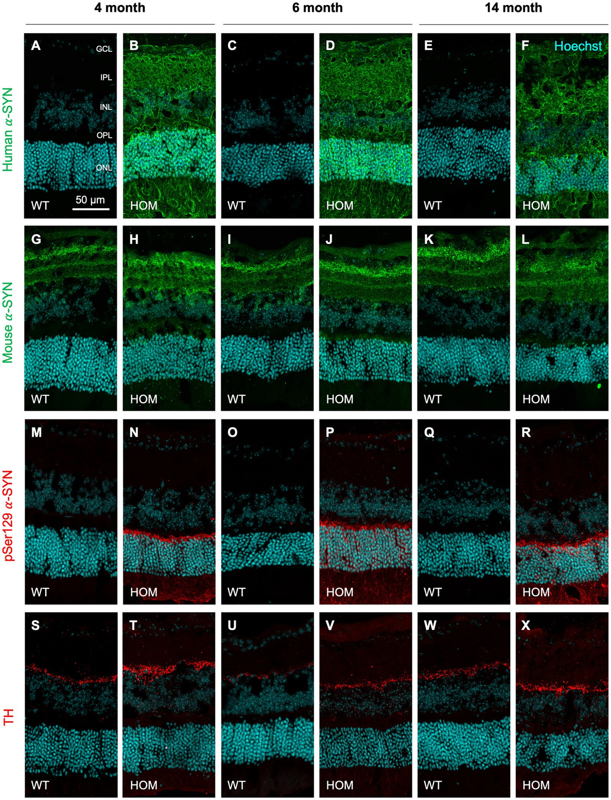 Frontiers | Retinal alpha-synuclein accumulation correlates