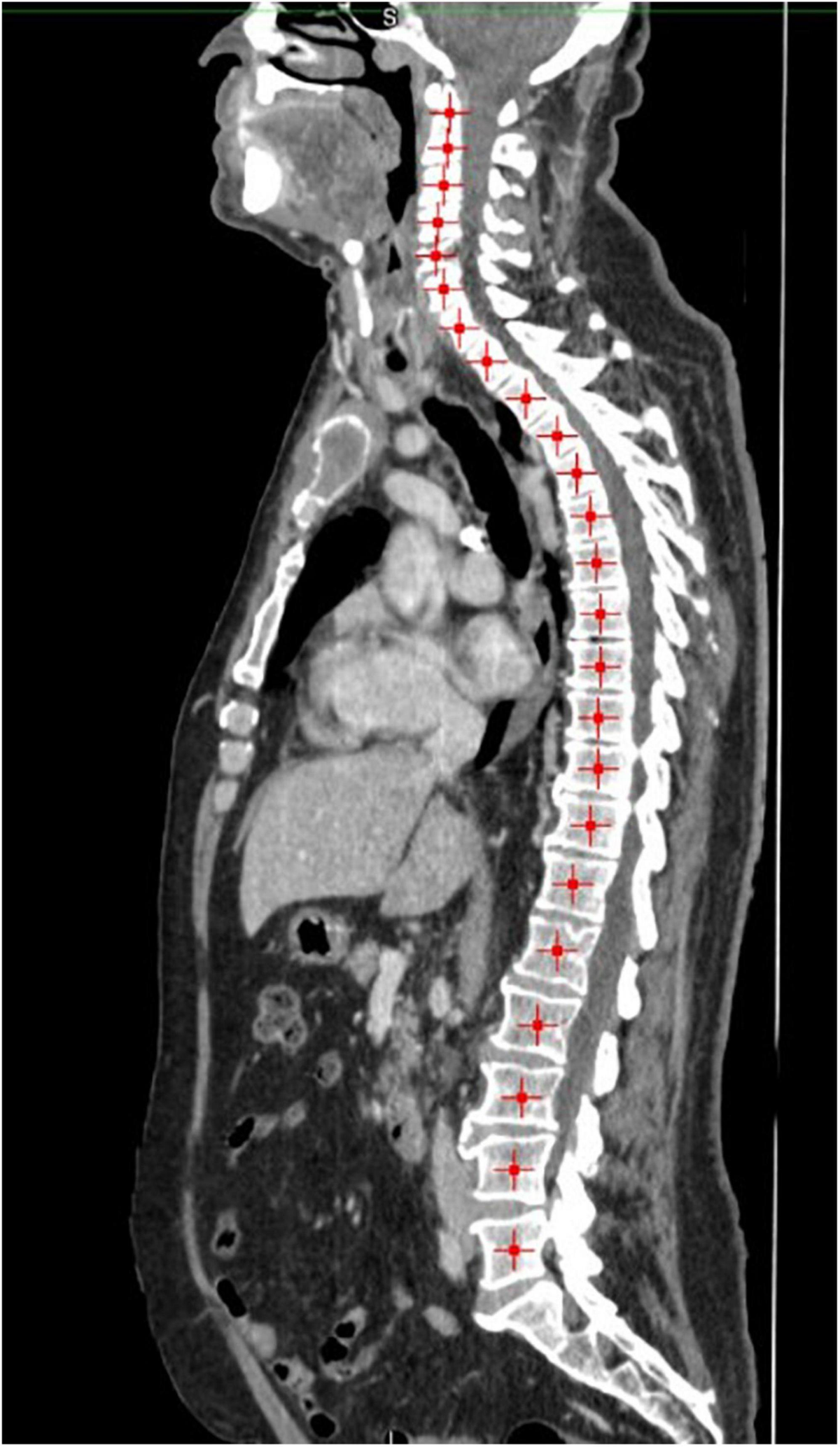 内科診断学 第4版　MEDICAL DIAGNOSIS Frontiers | Case report: Clinical highlights and