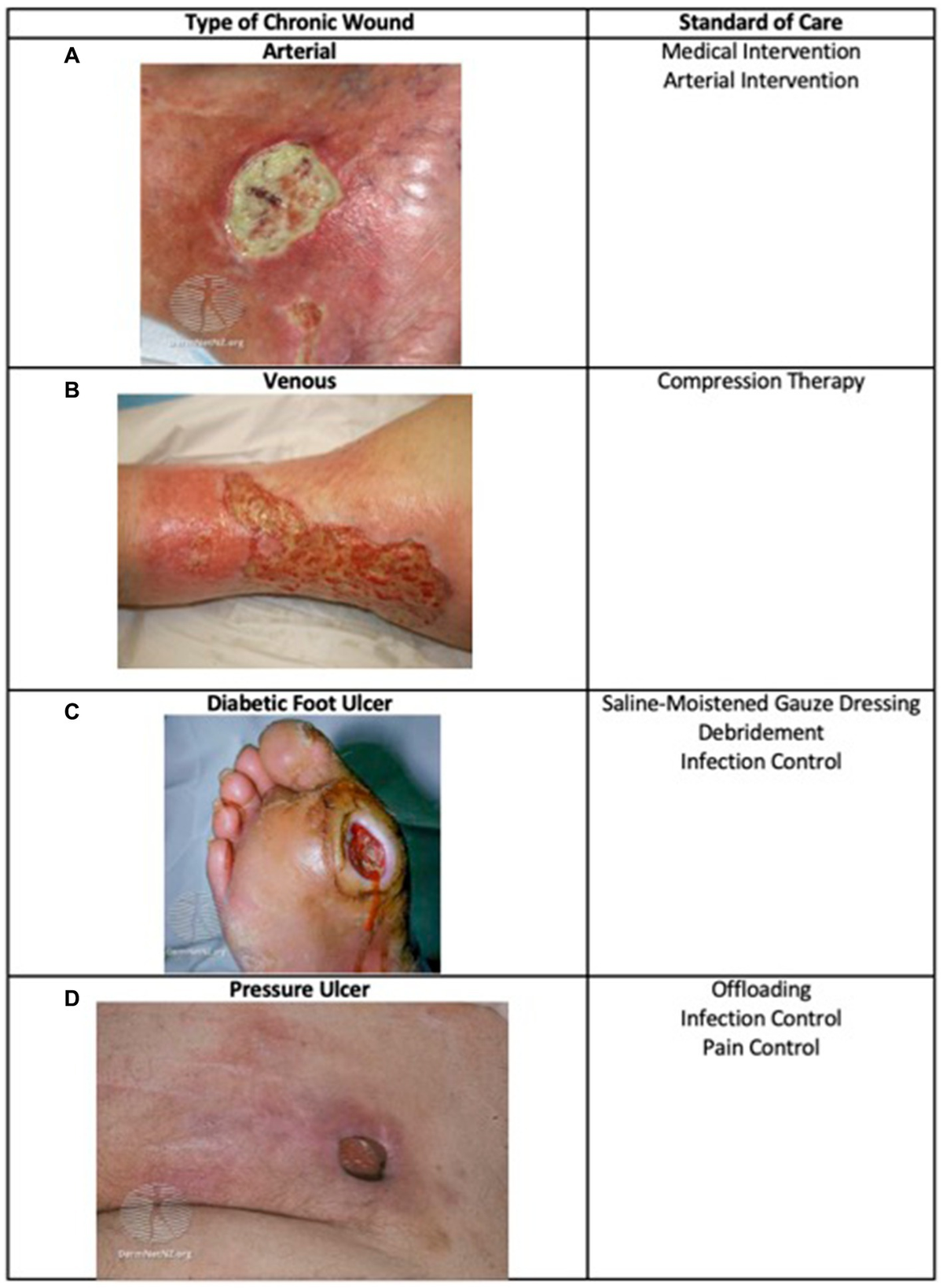 Frontiers | Skin substitutes as treatment for chronic wounds 