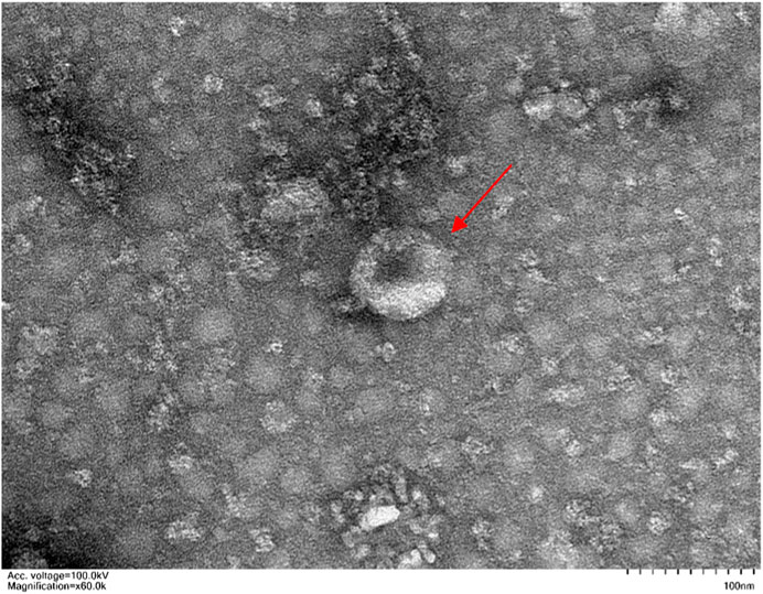 Frontiers | Role of nano-hydrogels coated exosomes in bone