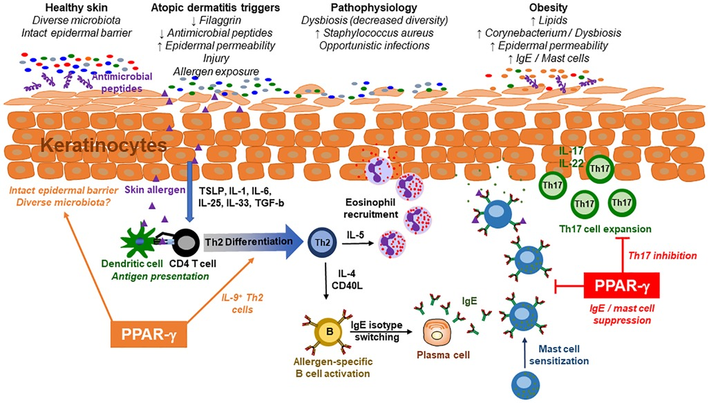 その他 Pathogenesis and Management of Atopic Frontiers | Obesity and the microbiome in atopic dermatitis