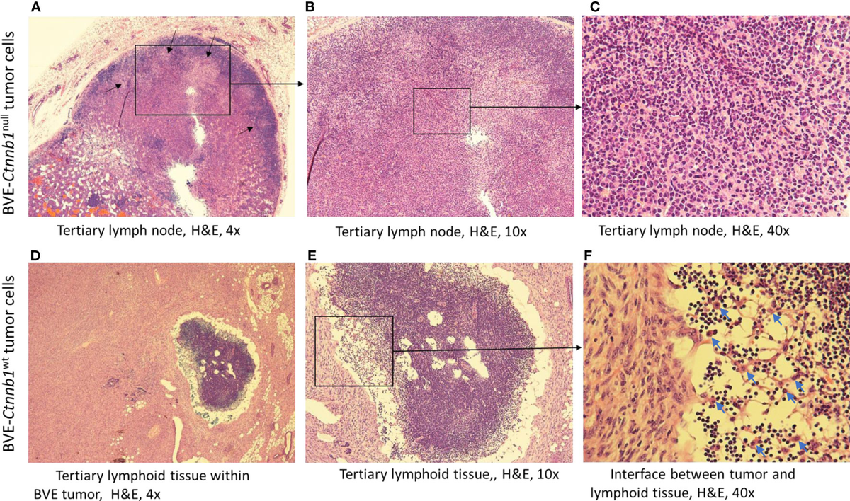 ルーイン細胞（第2版） Lewin's CELLS Identification of a TPP1 Q278X Mutation in an Iranian