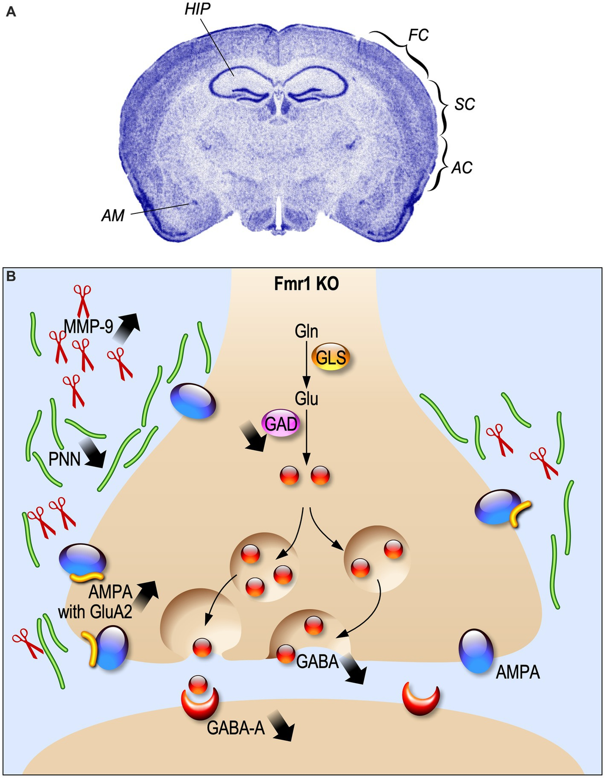 Frontiers | Fragile X Syndrome as an interneuronopathy: a
