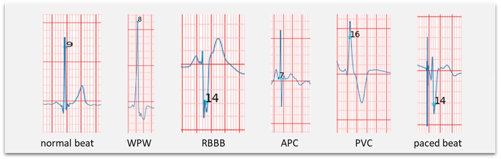 Apple watch ecg raw data online