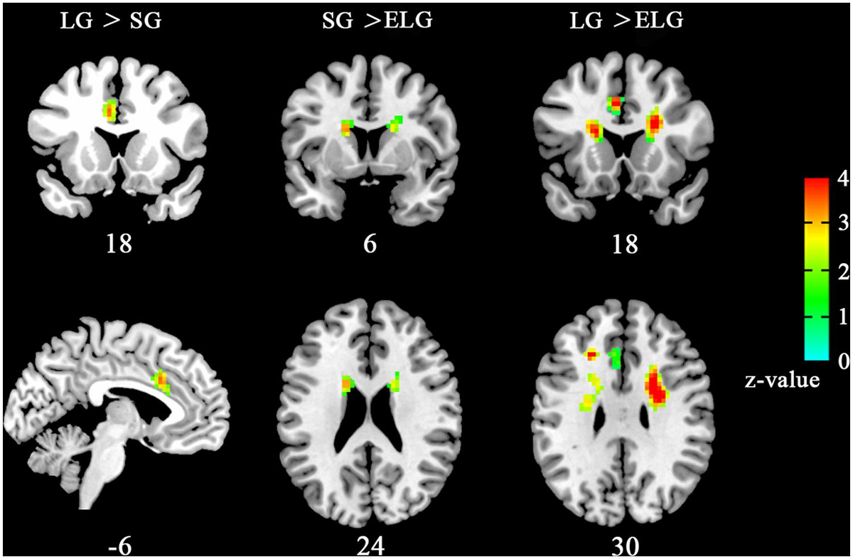 Frontiers | Love-related changes in the brain: a resting