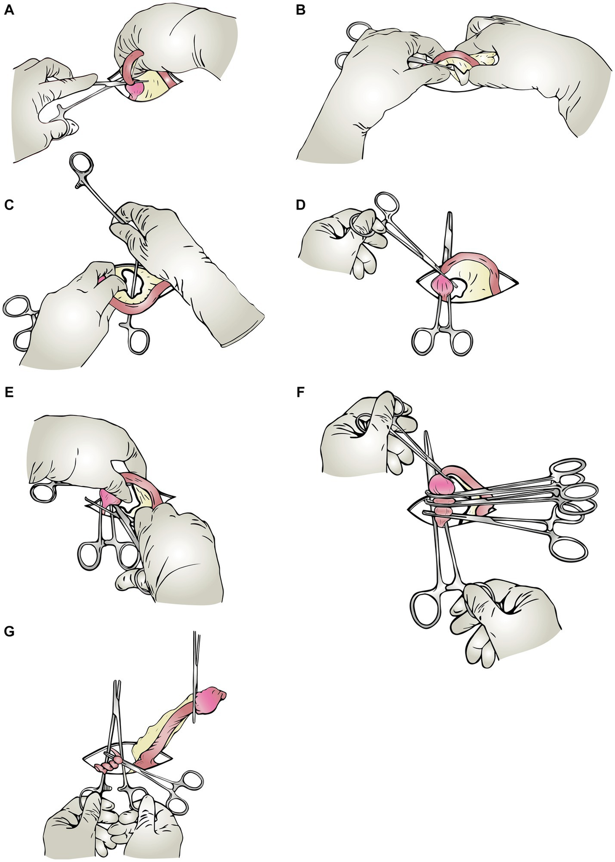 Instrument shank-assisted ovariohysterectomy: a randomized clinical trial of surgical and pain alleviation efficiency of a single-person modified technique