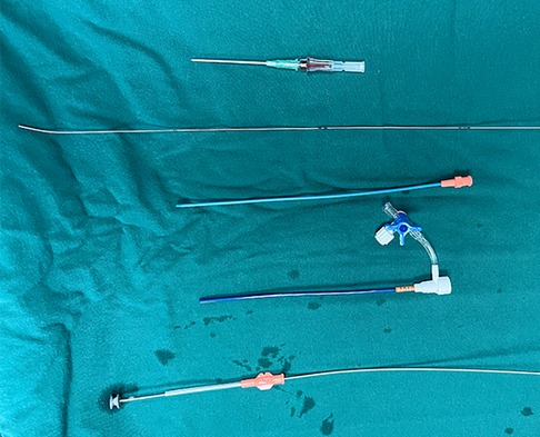 Frontiers | Transthoracic device closure of perimembranous
