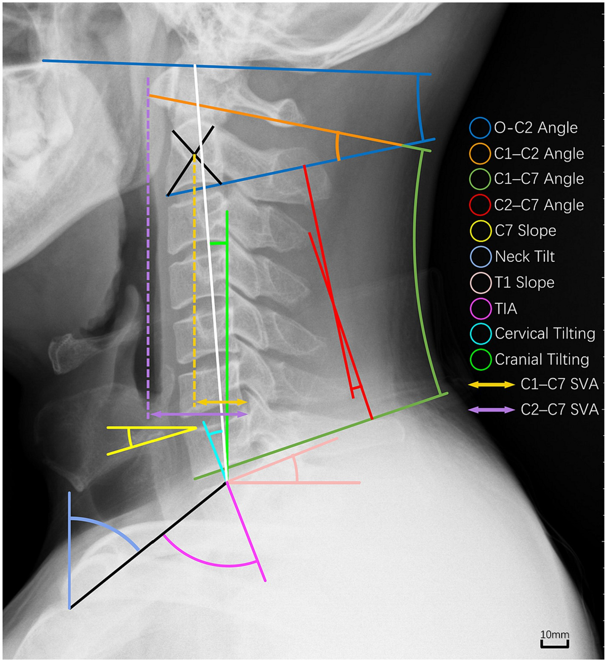 Frontiers | Prevalence and risk factors of occupational neck