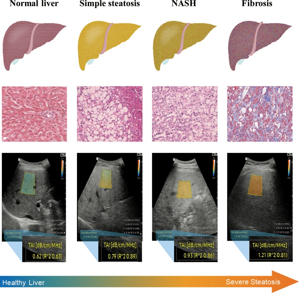 Frontiers | Protocol of quantitative ultrasound techniques for ...