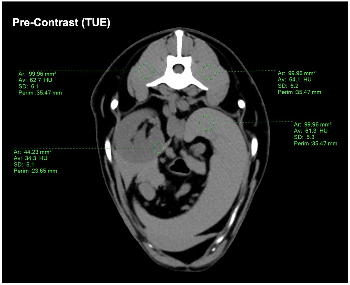 Frontiers | Virtual non-contrast images of detector-based