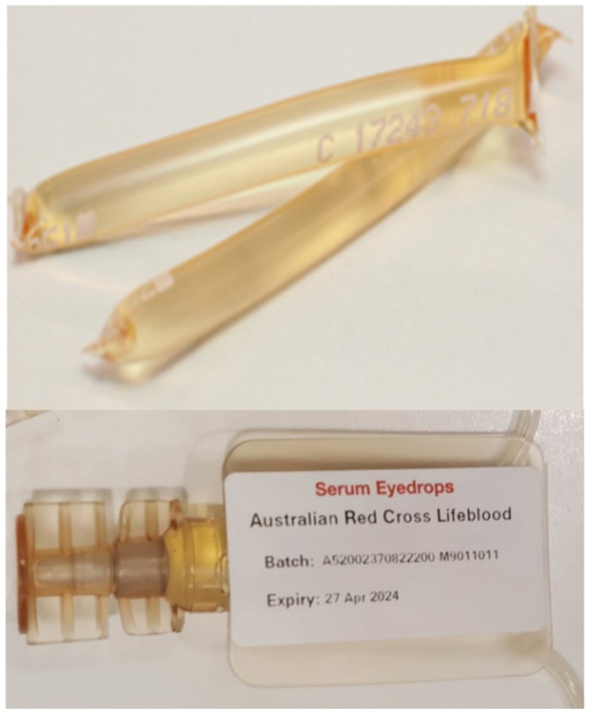 Frontiers Patientreported of serum eye drops manufactured