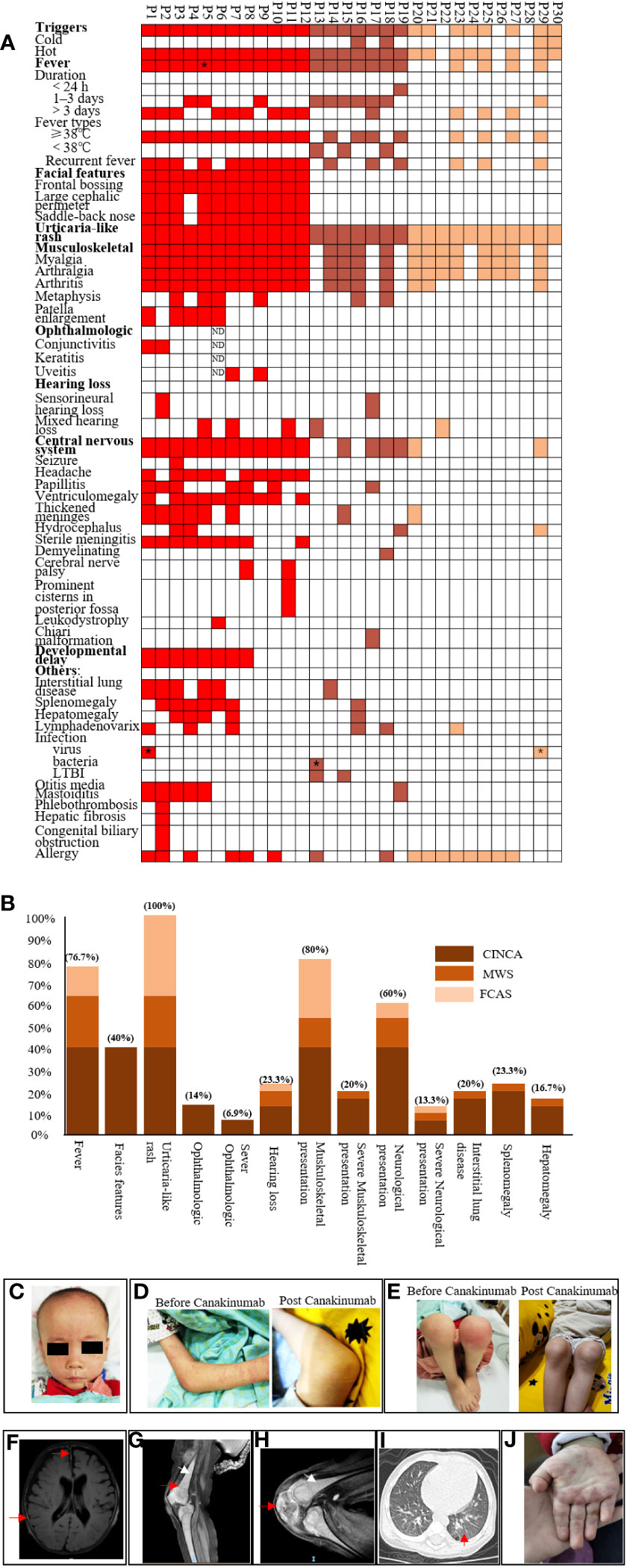 Frontiers | The genetic and clinical characteristics and effects of  Canakinumab on cryopyrin-associated periodic syndrome: a large pediatric  cohort study from China