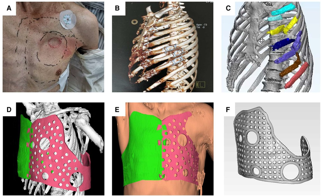 パート2 s-l400.jpg