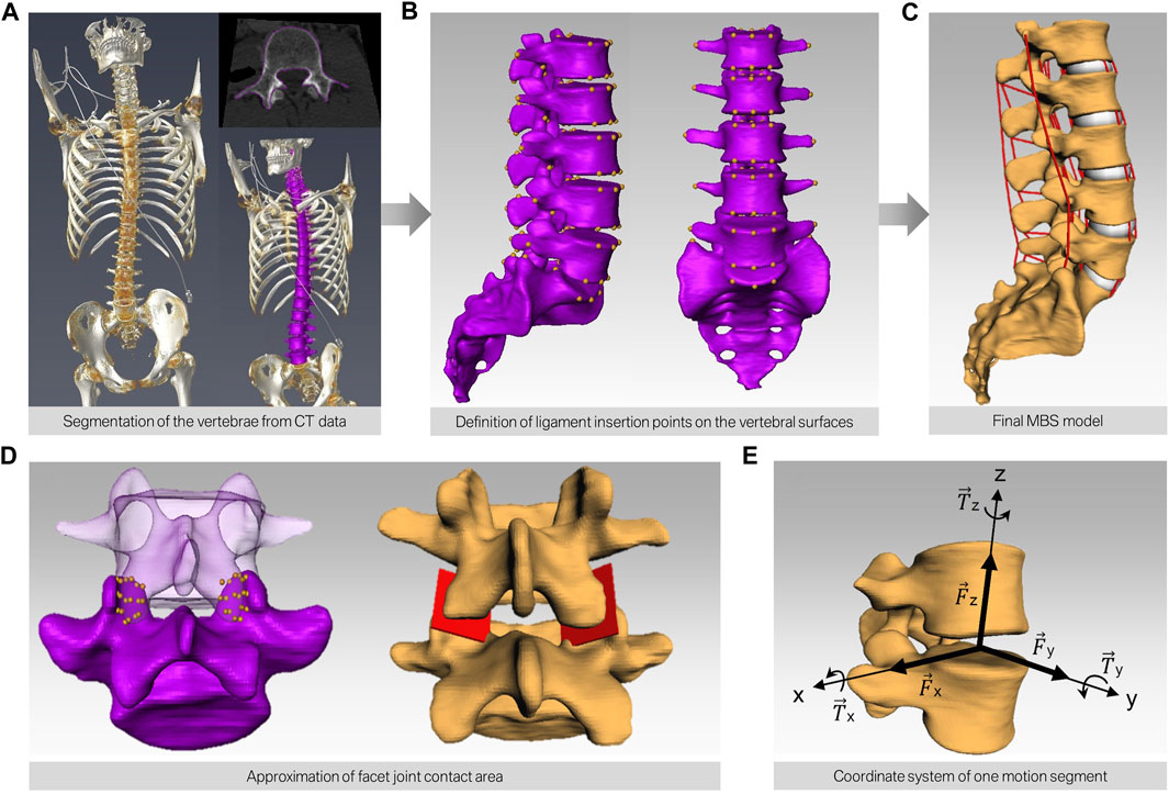 脊椎脊髄の手術 = Illustrated Surgery of Spine … Frontiers | Invasiveness of decompression surgery affects