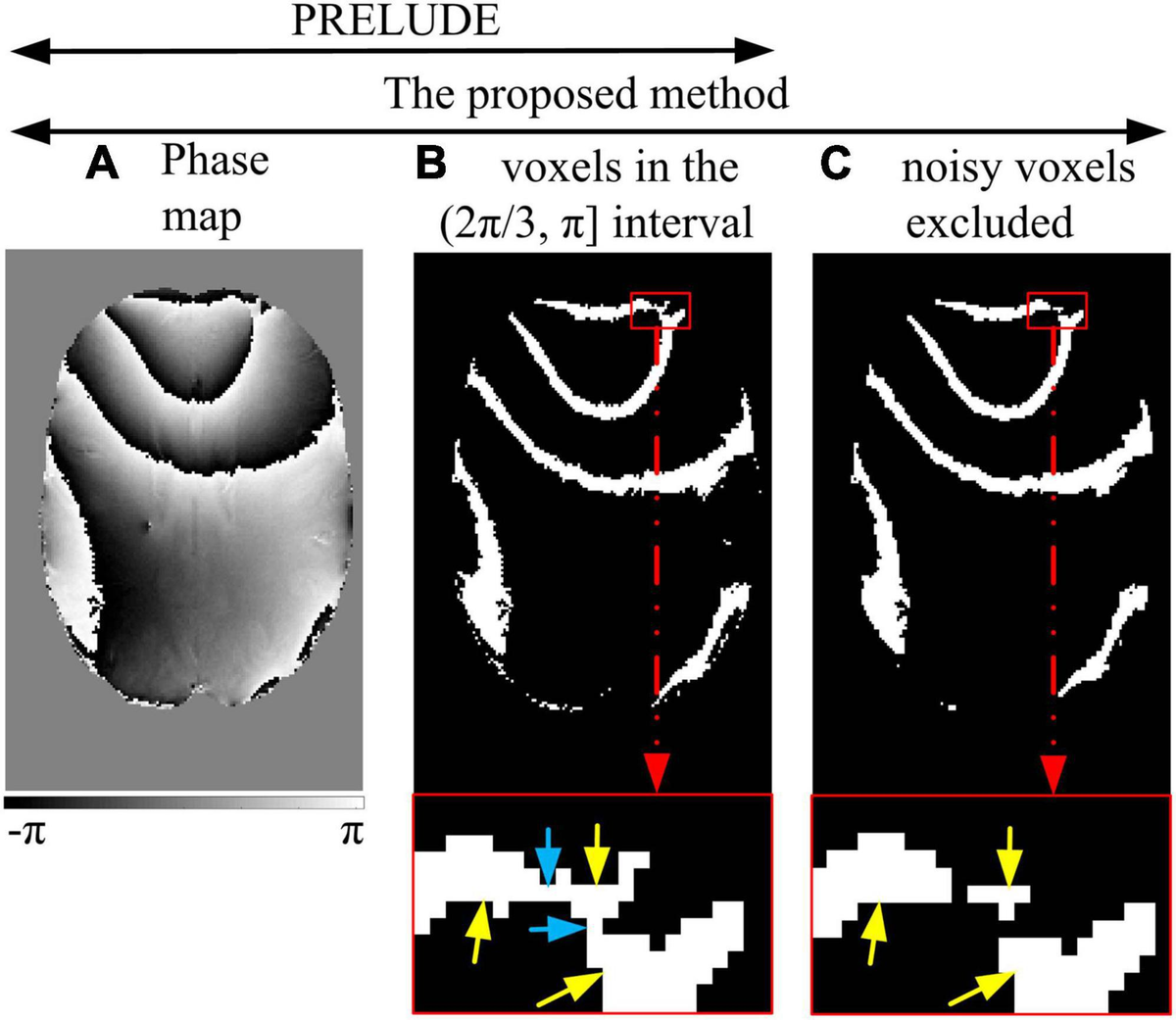 Frontiers | A new 3D phase unwrapping method by region