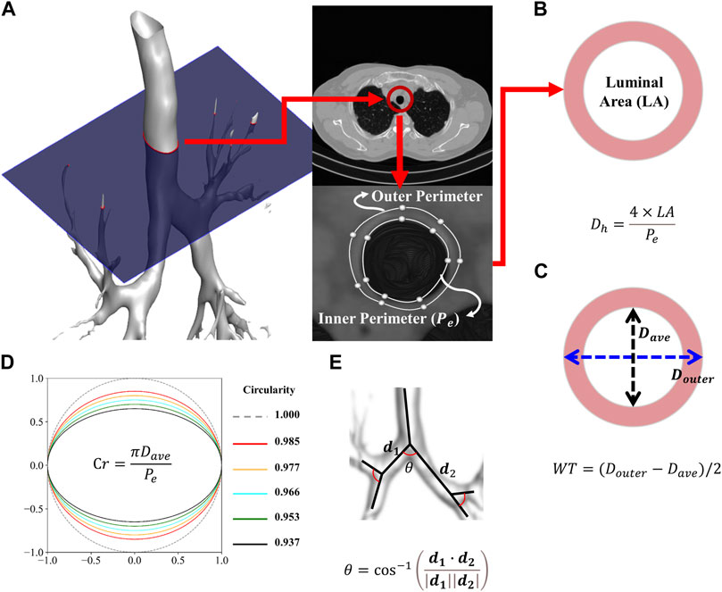 Frontiers | Computed tomography-based imaging biomarker