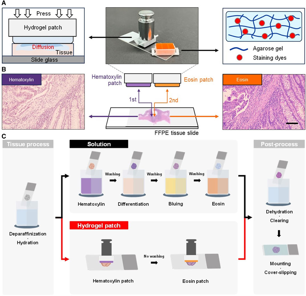 Frontiers | Solution-free and simplified H&E staining using a hydrogel ...