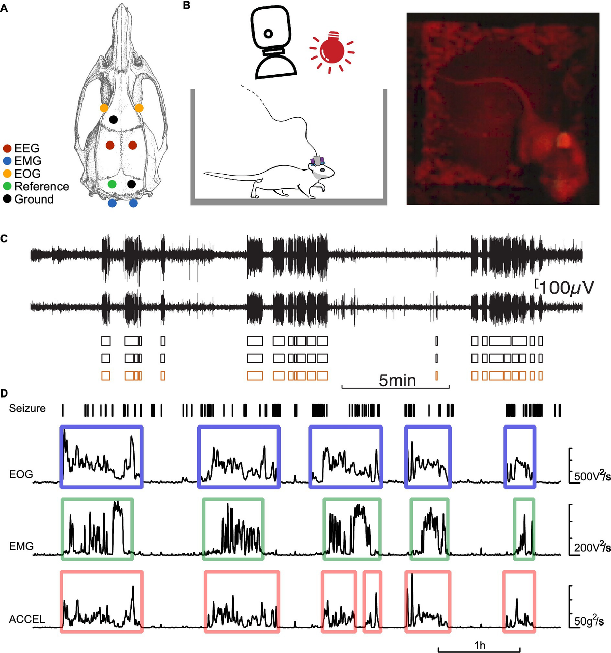 eeg 2011年 Frontiers | Epileptic seizure clustering and accumulation at